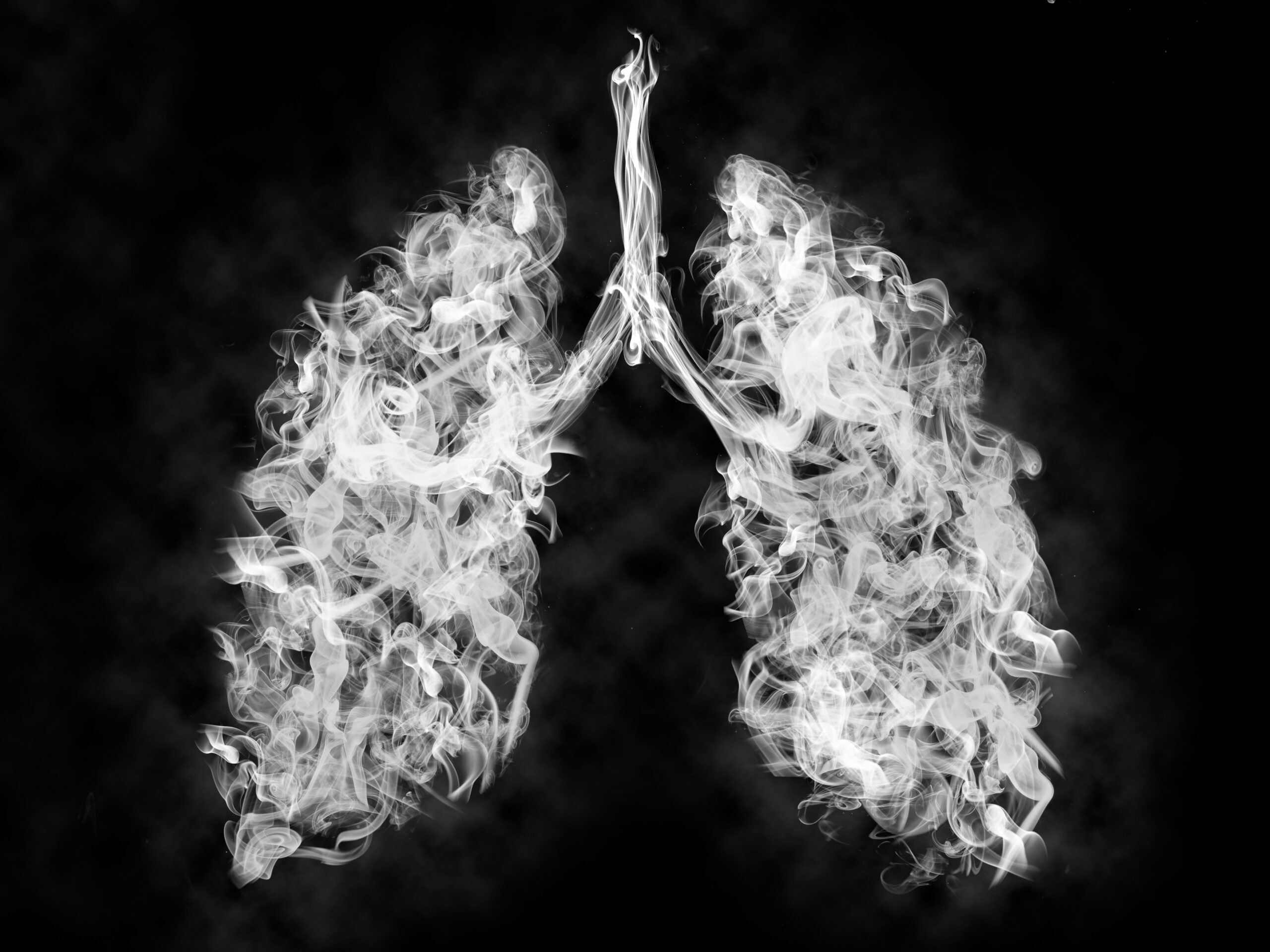 Smoking Cannabis Alters Lungs Differently Than Smoking Tobacco
